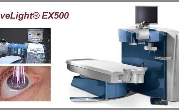 эксимерный лазер WAVELIGHT EX500 от Alcon